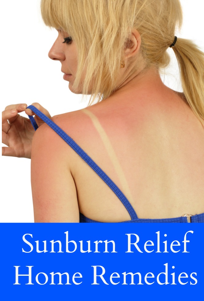 Sunburn Relief Home Remedies