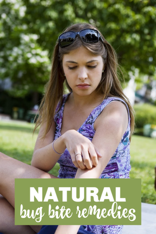 natural bug bite remedies